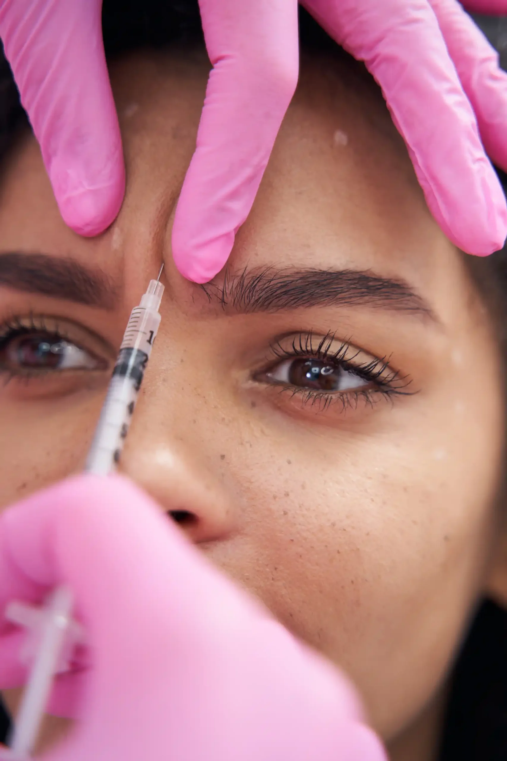 Botox By Mission Wellness