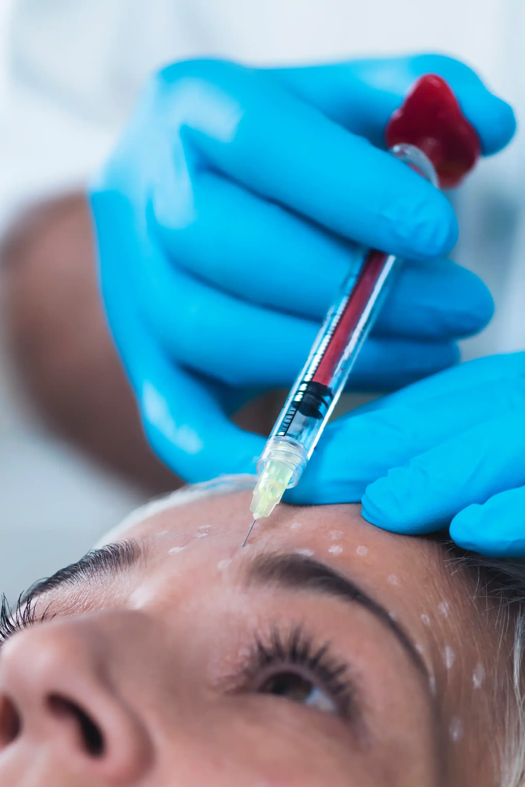 Platelet-Rich Plasma (PRP) Treatments By Mission Wellness