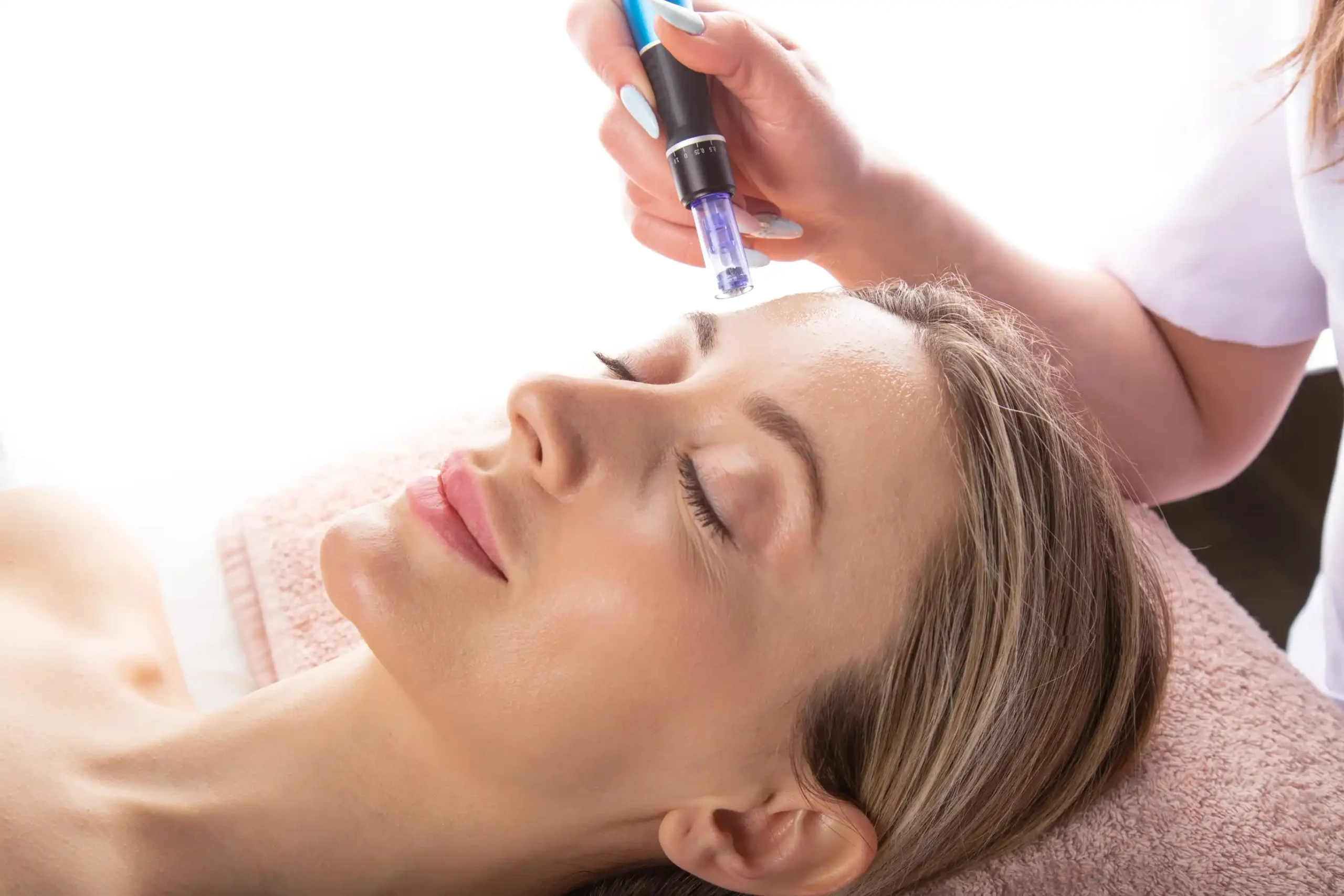 SkinPen® Microneedling & PRP By Mission Wellness