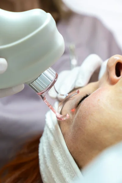 Facial Redness Removal
